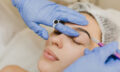 Brow Lift