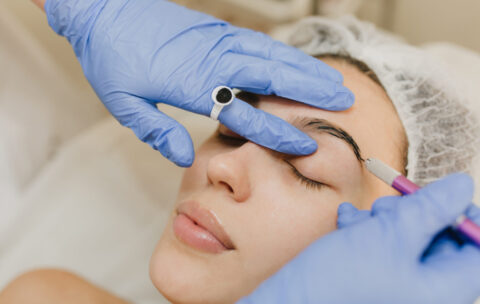 Brow Lift